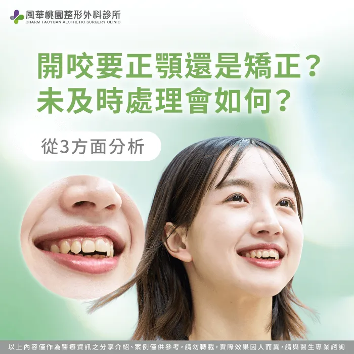 開咬正顎-正顎手術開咬