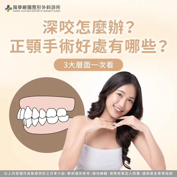 讓風華桃園整形外科診所深入說明深咬3大重點,以及建議正顎改善的原因 深咬怎麼辦-深咬正顎