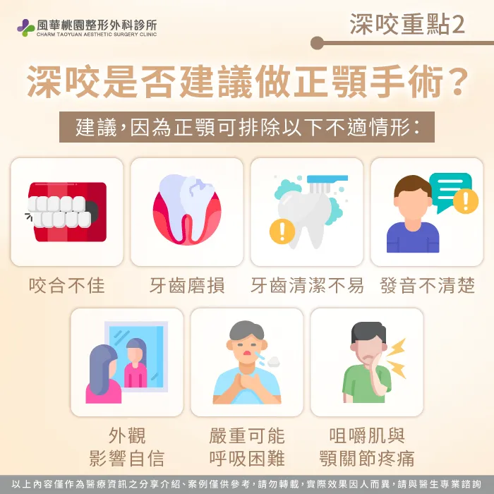 若深咬造成咬合不良、牙齒磨損、清潔困難或影響外觀,正顎手術能改善這些情形 深咬是否建議做正顎手術-深咬正顎