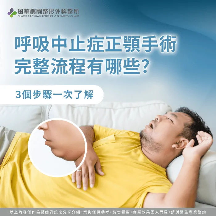 呼吸中止症 正顎手術-呼吸中止症 正顎