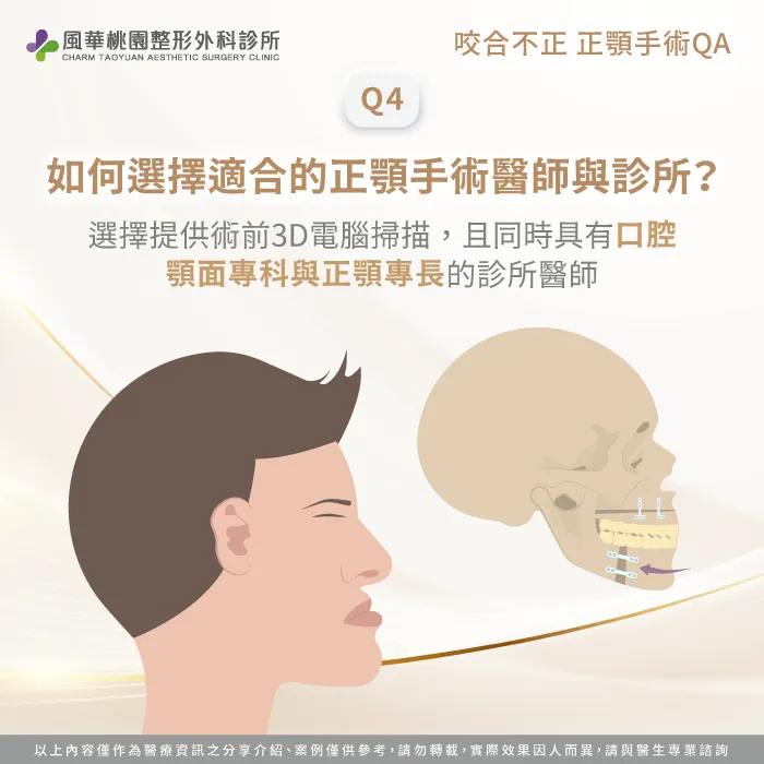 如何選擇適合的正顎手術醫師與診所-咬合不正正顎手術