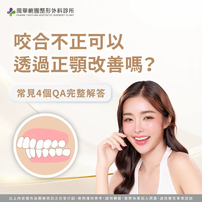 咬合不正正顎-咬合不正正顎手術