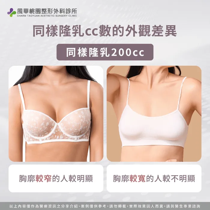 同樣隆乳cc數的外觀差異-珍珠波隆乳cc數