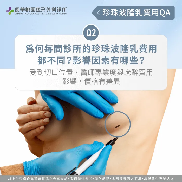 珍珠波隆乳費用的3個影響因素-珍珠波隆乳費用