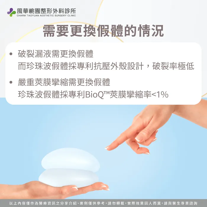 可能需要更換假體的情況-珍珠波假體需要更換嗎