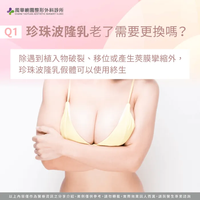 珍珠波隆乳老了需要更換嗎-珍珠波隆乳老了怎麼辦