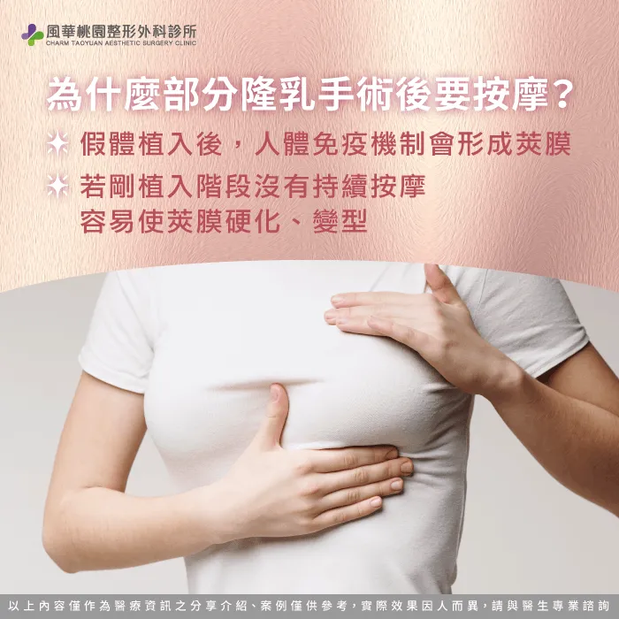 為什麼隆乳手術要按摩-珍珠波隆乳要按摩嗎