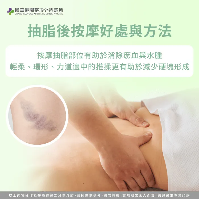 抽脂後按摩好處-抽脂要按摩嗎