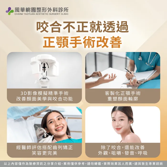 正顎手術4大優勢-正顎推薦