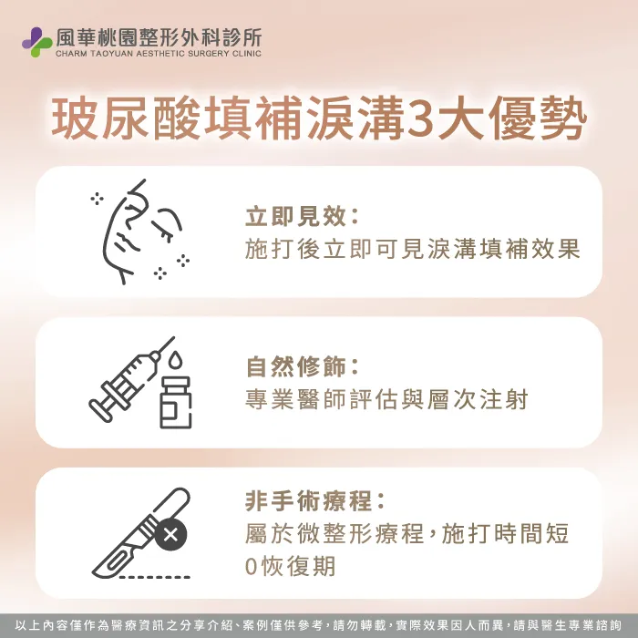 玻尿酸注射淚溝的優勢-淚溝玻尿酸
