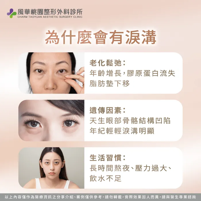 常見的淚溝成因-微整形玻尿酸