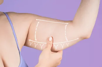 桃園手臂抽脂-桃園手臂抽脂推薦