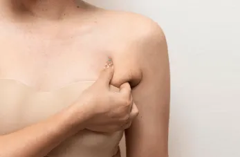 桃園手臂抽脂-桃園手臂抽脂手術