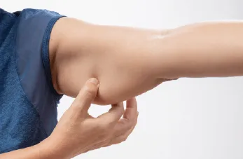 桃園手臂抽脂推薦-桃園手臂抽脂手術