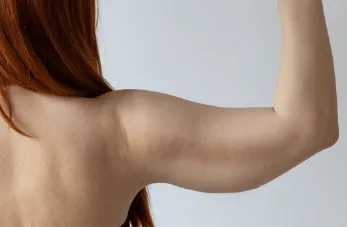 桃園手臂抽脂推薦-桃園手臂抽脂手術