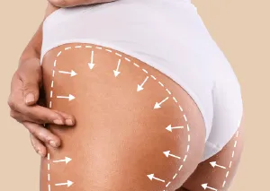 桃園自體脂肪豐臉推薦-桃園自體脂肪豐臉