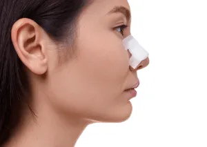 桃園自體肋骨隆鼻手術-桃園自體肋骨隆鼻