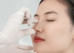 桃園自體肋骨隆鼻手術-桃園自體肋骨隆鼻