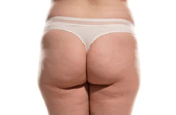 桃園臀部抽脂-桃園臀部抽脂推薦