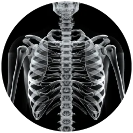 肋骨墊下巴手術-桃園墊下巴手術