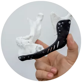 骨水泥墊下巴手術-桃園墊下巴手術推薦