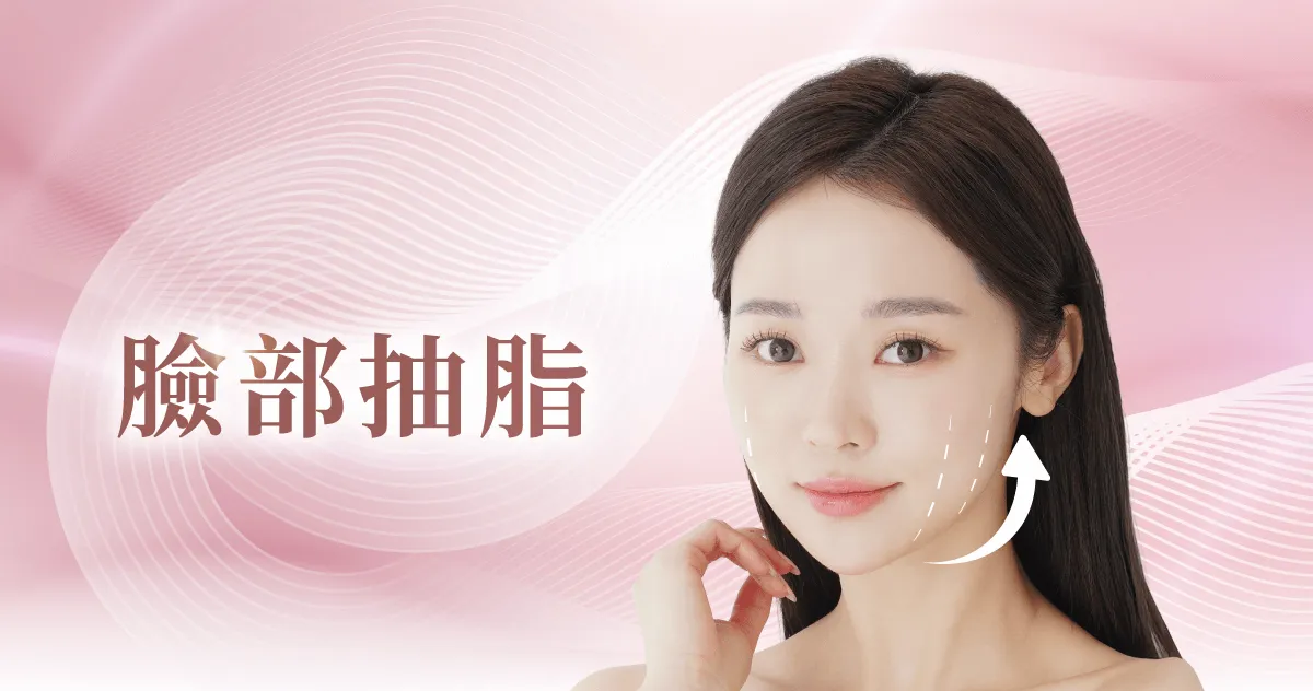 桃園雙下巴抽脂-桃園臉部抽脂推薦