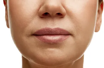 桃園嘴邊肉抽脂-桃園臉部抽脂推薦