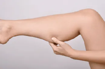 小腿抽脂-桃園小腿抽脂