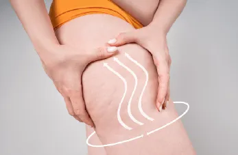 大腿環狀抽脂-桃園大腿環抽