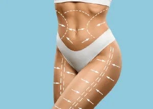 桃園抽脂推薦-桃園體雕推薦