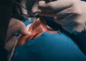 鼻翼手術推薦-桃園鼻翼縮小手術