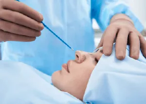 鼻翼縮小手術推薦-桃園鼻翼手術