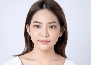 鼻翼手術推薦-桃園鼻翼縮小手術