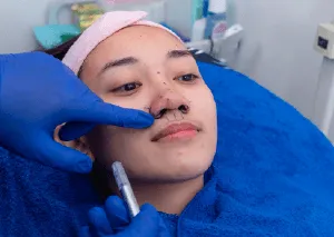 桃園鼻頭整形推薦-桃園鼻頭整形手術