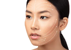 桃園臉部埋線推薦-桃園鼻唇溝填補