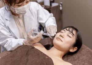 桃園臉部埋線-桃園鼻唇溝填補推薦